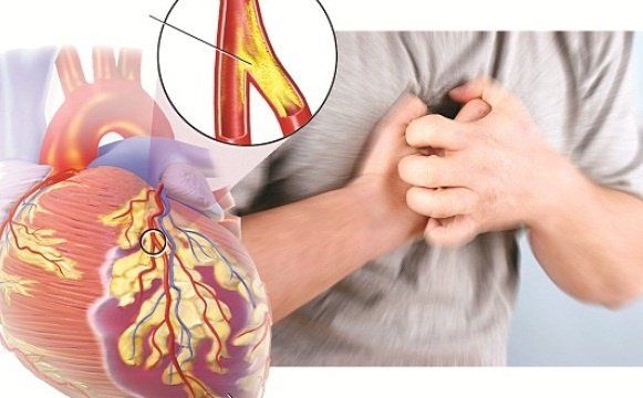Bệnh tim ảnh hưởng như thế nào đến cơ thể bạn?