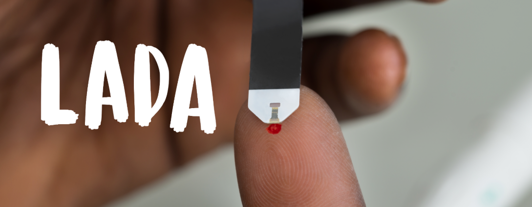 Chẩn đoán sớm đái tháo đường 1,5 tiềm ẩn ở người lớn