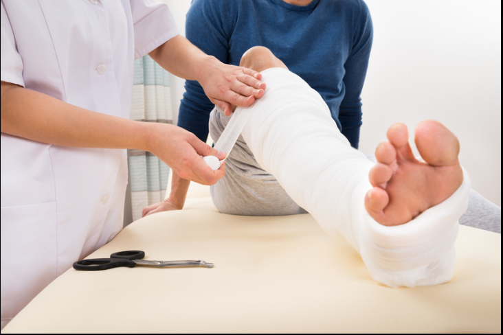 Nẹp bột và máng bột trong điều trị chấn thương gãy xương