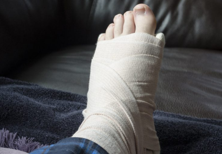 Nẹp bột và máng bột trong điều trị chấn thương gãy xương