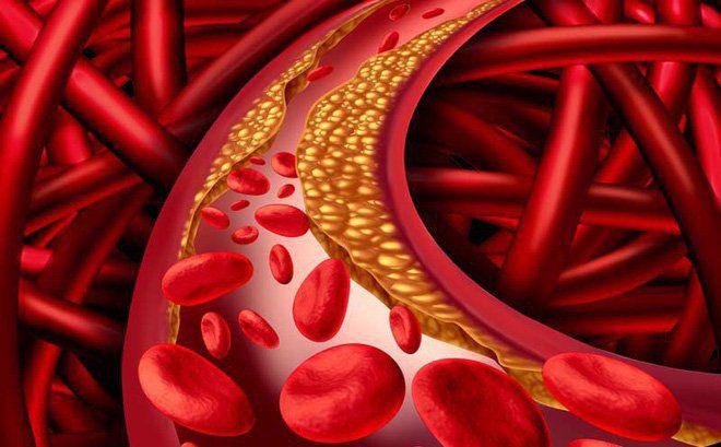 Cholesterol trong máu: Các chỉ số cần biết