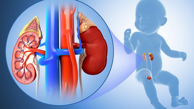 Điều trị viêm cầu thận ở trẻ nhỏ