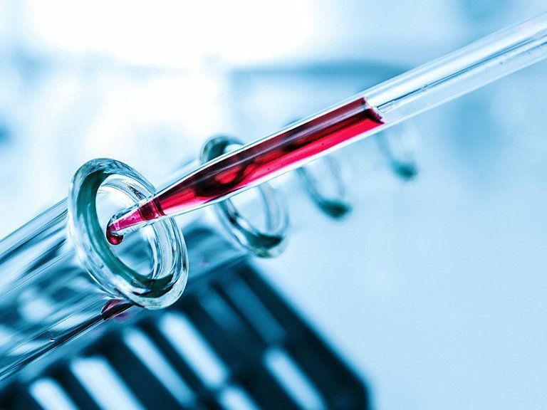 Hội chứng Sjogren: Cách nhận biết và điều trị