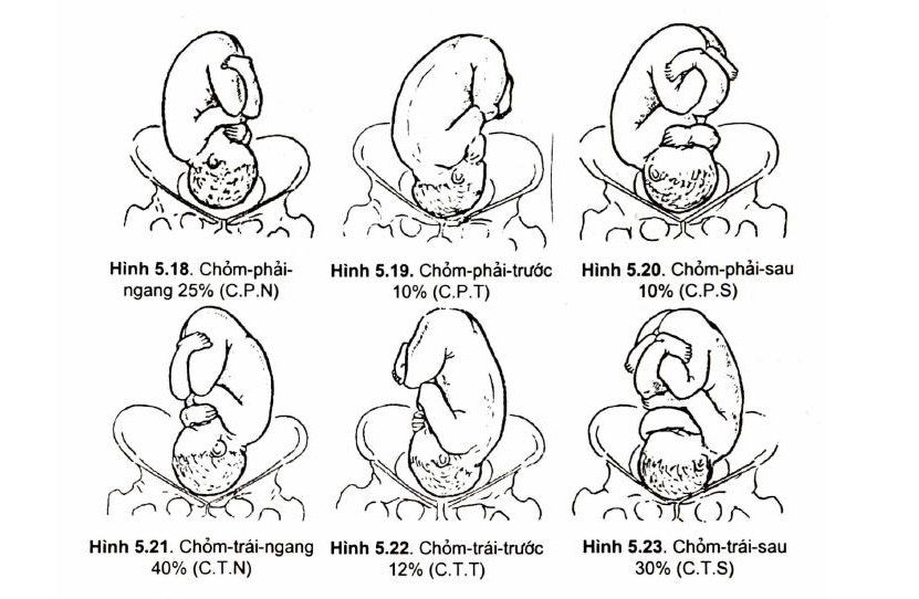 Nghiệm pháp lọt ngôi chỏm và những điều cần biết