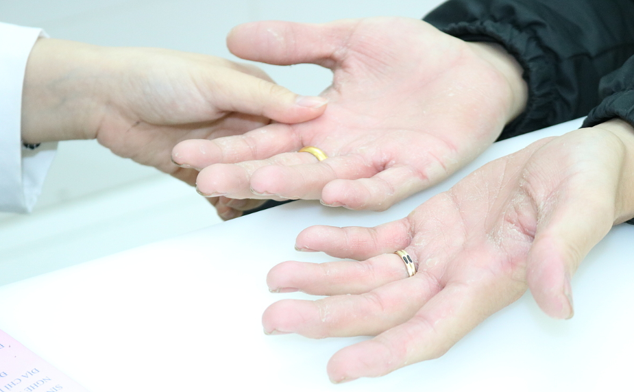 Điều trị bệnh Parkinson