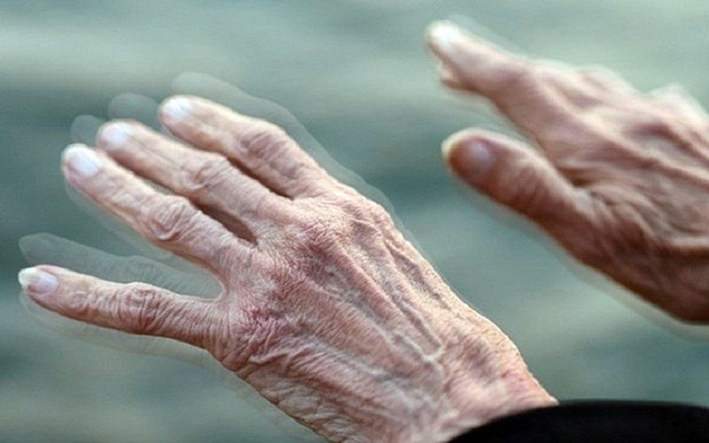 Bệnh Parkinson: Những điều cần biết