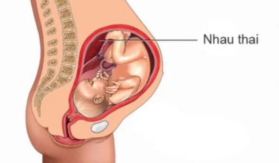 Nghiệm pháp bong rau, đỡ rau, kiểm tra bánh rau để làm gì?