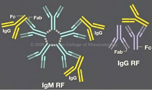 Xét nghiệm yếu tố dạng thấp (RF) trong viêm khớp dạng thấp