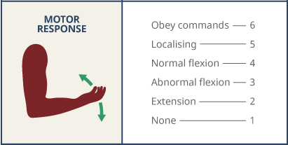 Thang điểm glasgow là gì? Ý nghĩa thang điểm glasgow trong hôn mê