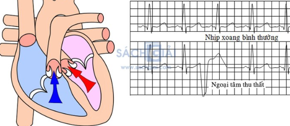 Huyết động học là gì?