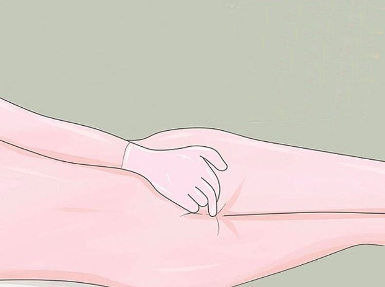 Hướng dẫn cách dùng dung dịch thụt trực tràng microclismi