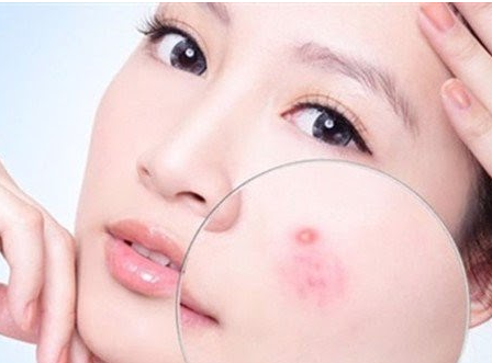 10 dấu hiệu không thể bỏ qua của da nhạy cảm