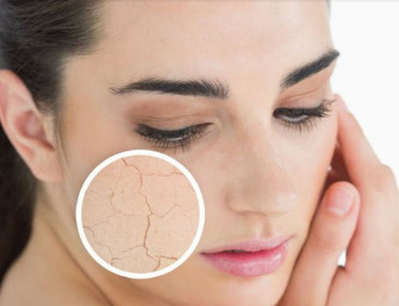 10 dấu hiệu không thể bỏ qua của da nhạy cảm