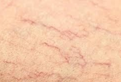 10 dấu hiệu không thể bỏ qua của da nhạy cảm