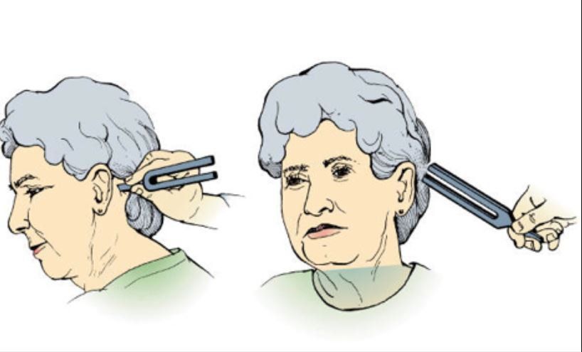 Cách khám 12 đôi dây thần kinh sọ não