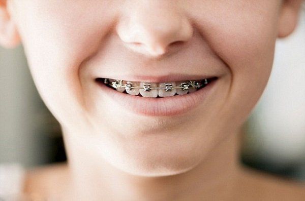 Chụp X quang răng được chỉ định trong trường hợp nào?