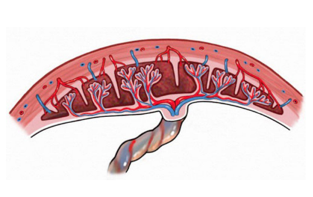 Ứng dụng siêu âm trong chẩn đoán bệnh lý bánh nhau thai