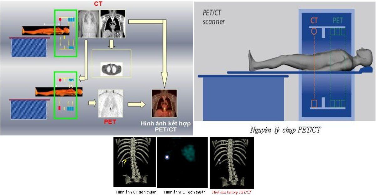 Chụp PET/CT có an toàn?