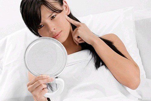 Tăng sắc tố, giảm sắc tố và làn da của bạn