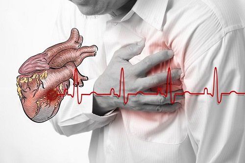 Điện châm điều trị hội chứng vai gáy