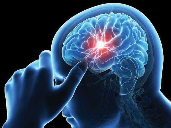 Chụp cắt lớp vi tính sọ não không tiêm thuốc đối quang chẩn đoán u não trong trục