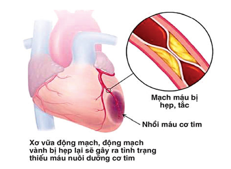 Hiểu biết về chất béo và lựa chọn chất béo thông minh