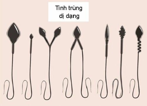 Hình thái tinh trùng bất thường có ý nghĩa là gì?