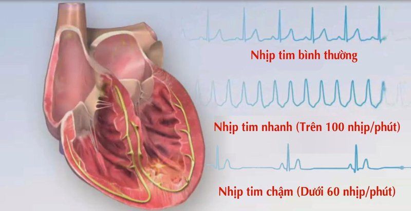 Phân biệt sốc tim, sốc giảm thể tích, sốc tắc nghẽn
