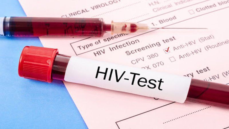 Phát ban HIV là gì ? Triệu chứng phát ban HIV