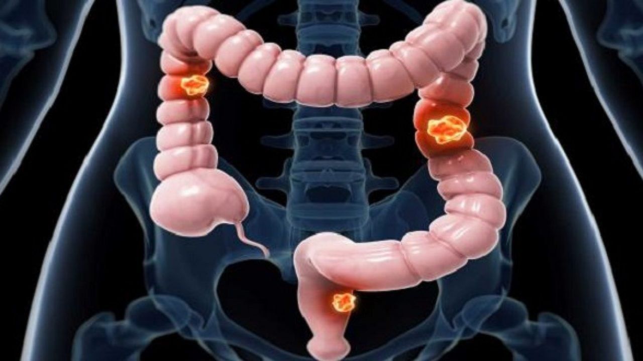 Các ứng dụng mới của trí tuệ nhân tạo trong lĩnh vực tiêu hóa