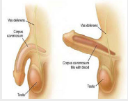 Các chấn thương dương vật và tinh hoàn có thể gặp