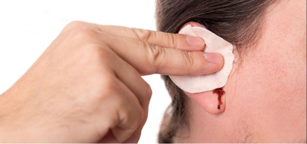 Xử trí chấn thương tai - mũi - họng