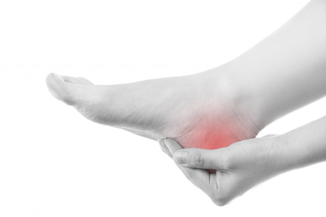 Phục hồi chức năng viêm cân gan bàn chân