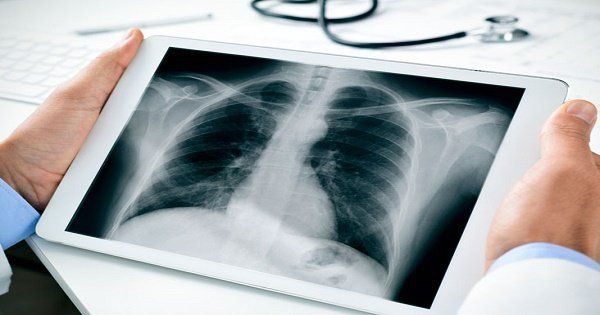 Khả năng xuyên thấu của tia X