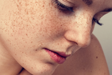 Thuốc Altreno: Công dụng, chỉ định và lưu ý khi dùng