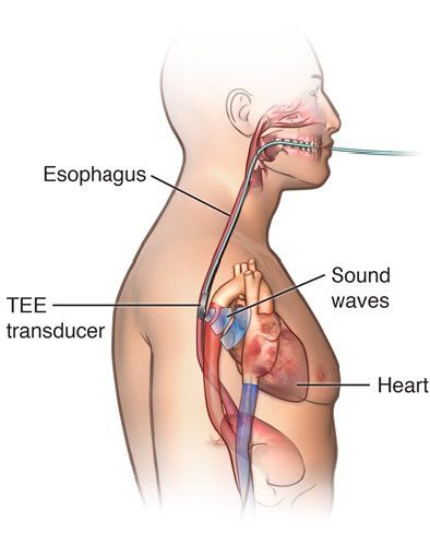 Một số lát cắt thường dùng trong siêu âm tim thực quản