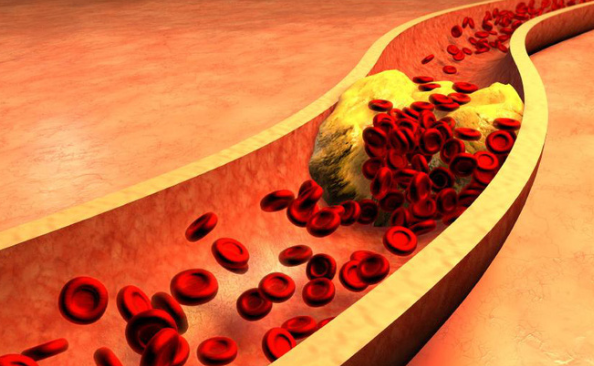 Cholesterol trong máu: Các chỉ số cần biết