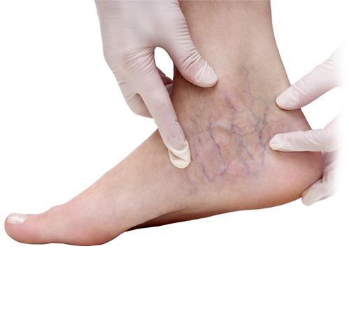 Thuốc mỡ kháng sinh bôi ngoài da: Chớ tùy tiện