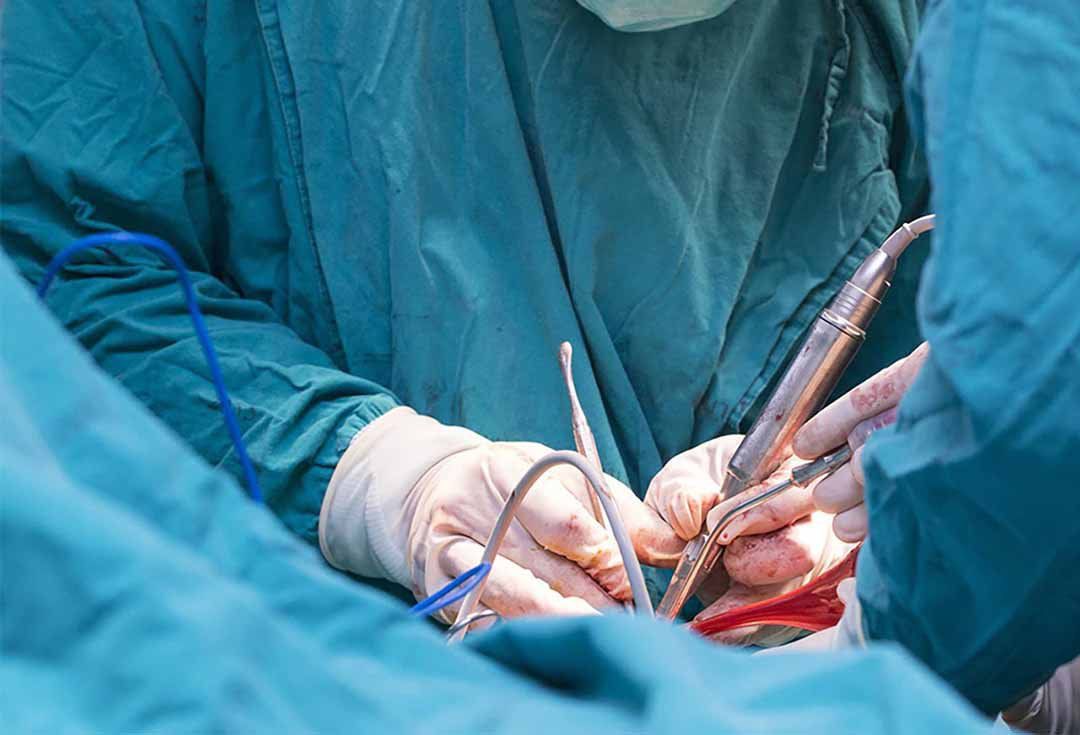 U tủy sống nguyên phát ngoài tủy