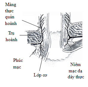 Cơ hoành và thoát vị khe hoành