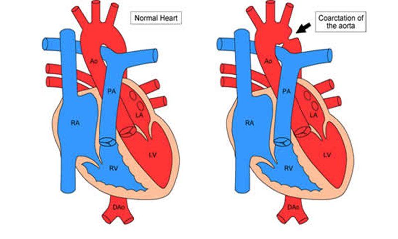 Các dấu hiệu sốc tim điển hình có thể nhận biết ngay