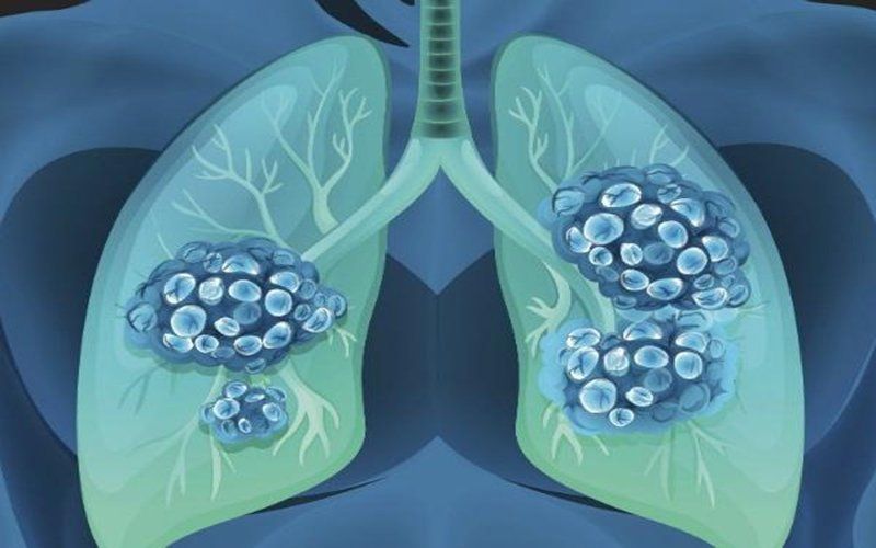 Thương tổn do hít khói – Những điều cần biết