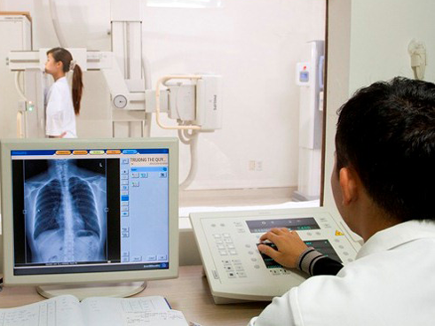 Trường hợp nào không cần cởi áo khi chụp X quang phổi?
