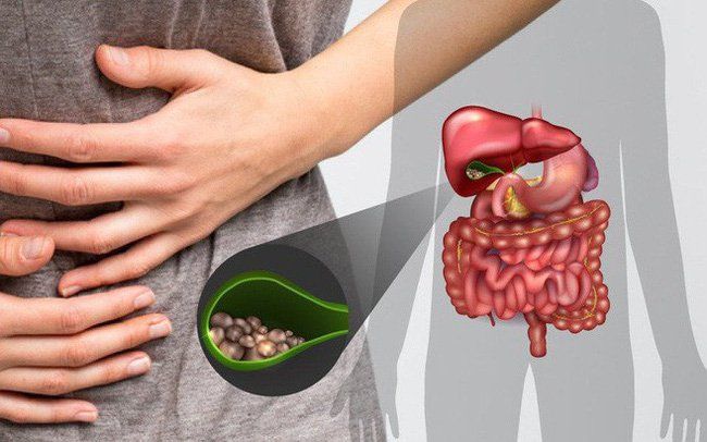 Chụp cắt lớp vi tính chẩn đoán các bệnh đường mật