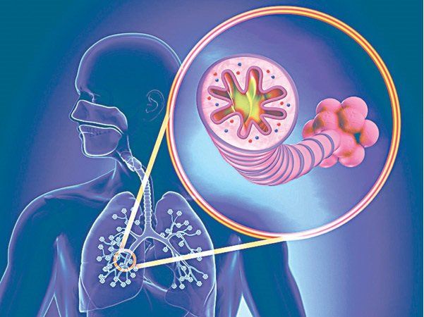 X-quang ngực có chẩn đoán bệnh phổi tắc nghẽn mạn tính (COPD) không?