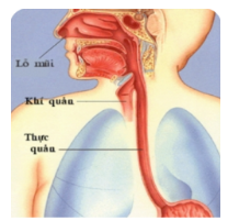 Sơ cấp cứu dị vật đường thở - nghẹt thở