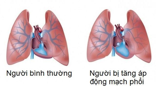 Các thông số chính trong siêu âm Doppler tim