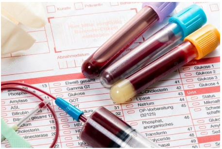 Tìm hiểu về chỉ số ước lượng glucose máu trung bình (eAG)