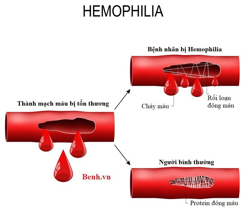 7 xét nghiệm gen cần làm trong thai kỳ