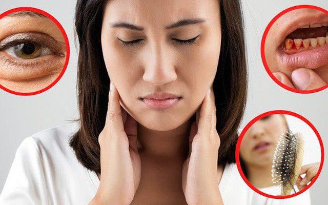 Tóc mỏng, da có vảy khô, móng dễ gãy: Cảnh giác thiếu Vitamin B7 (biotin)